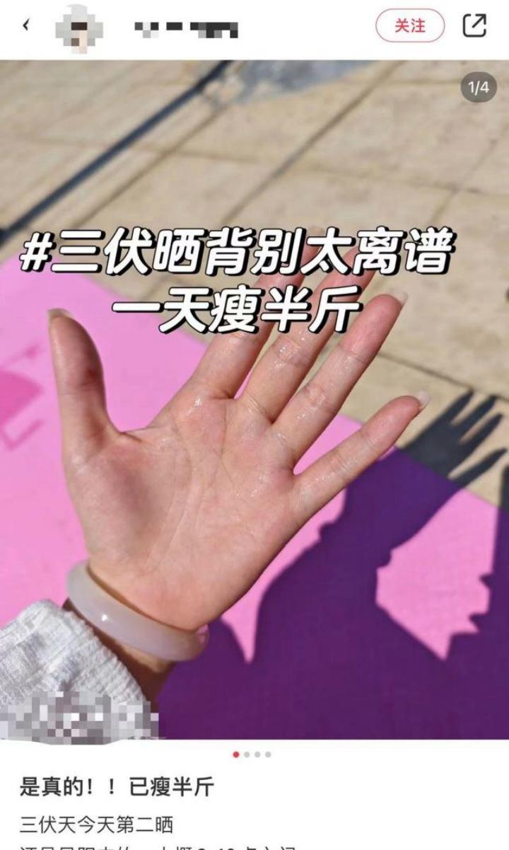 女子称晒背2小时后排出宿便